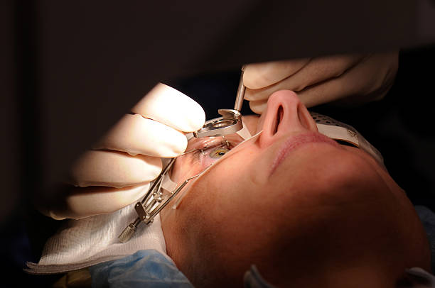 Everything you need to know about eye surgery